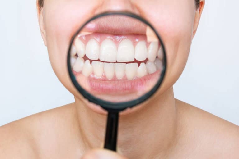 Close-up magnifying glass on teeth examining oral health to address chronic bad breath