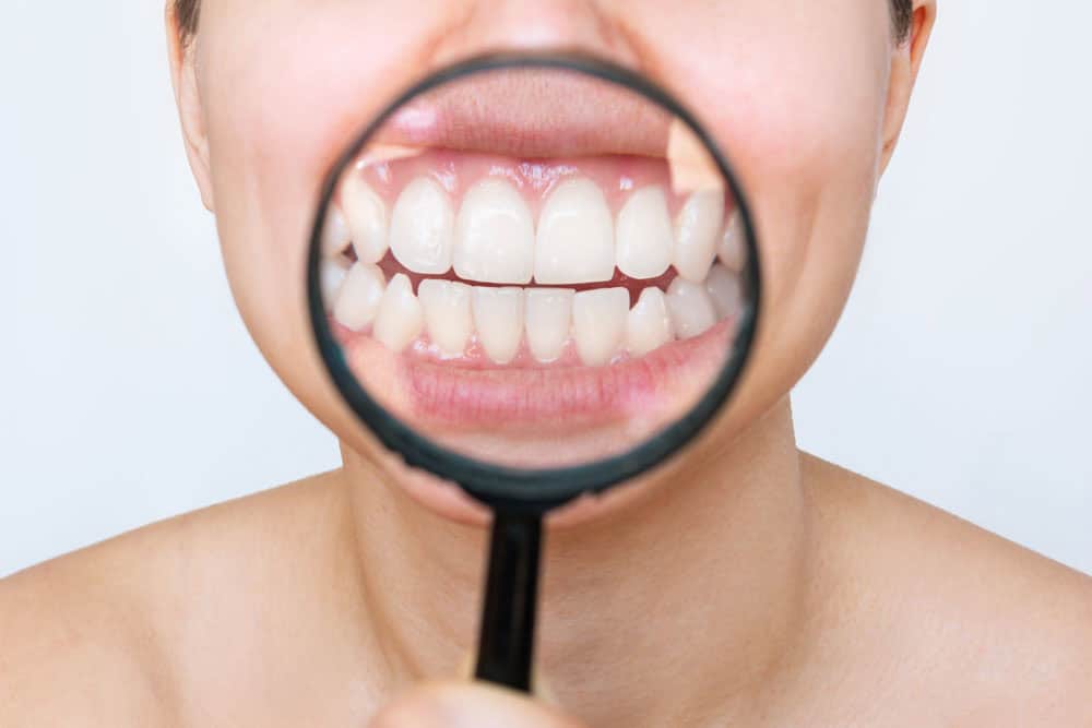 Close-up magnifying glass on teeth examining oral health to address chronic bad breath
